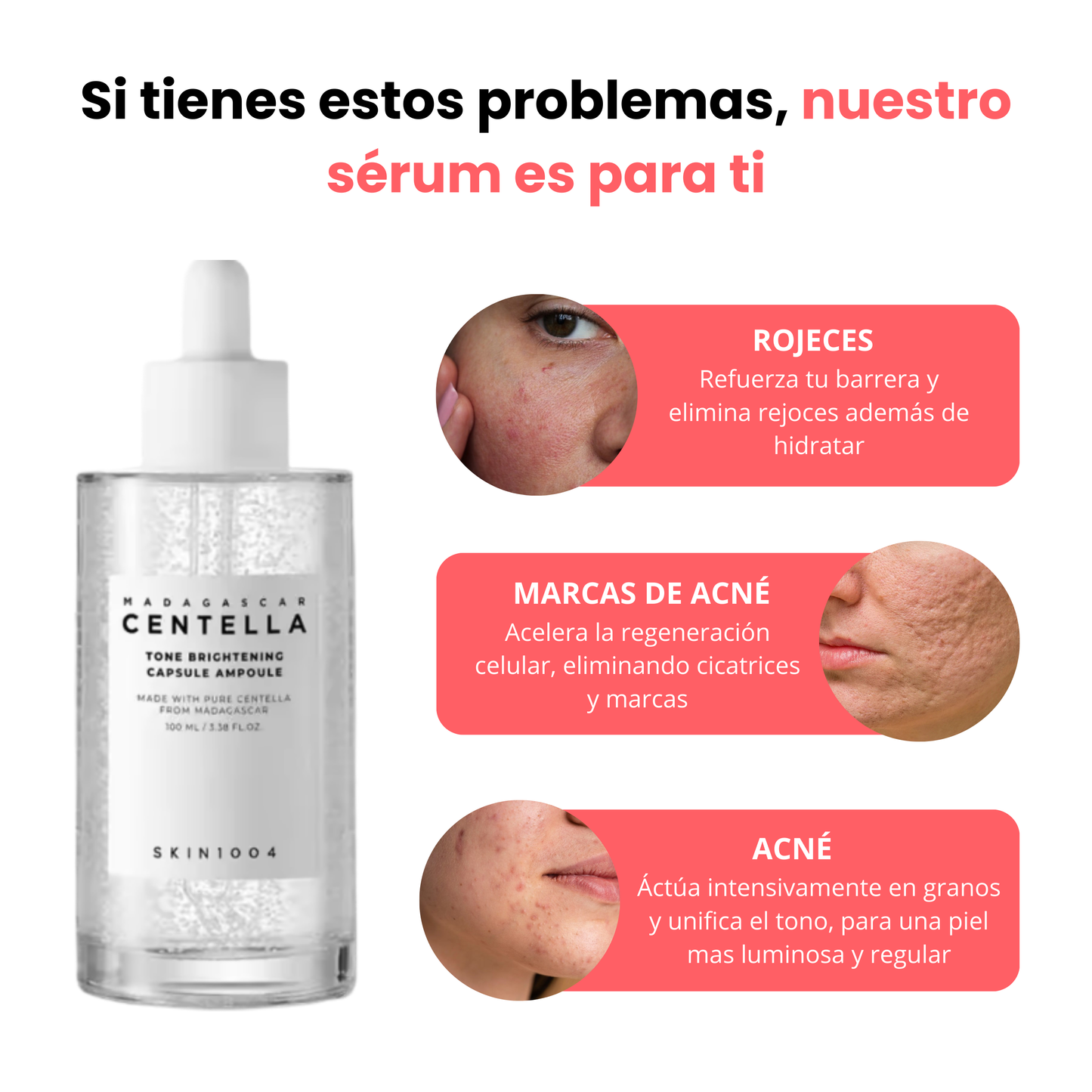 Sérum anti acné y rojeces de centella asiática | 100ml