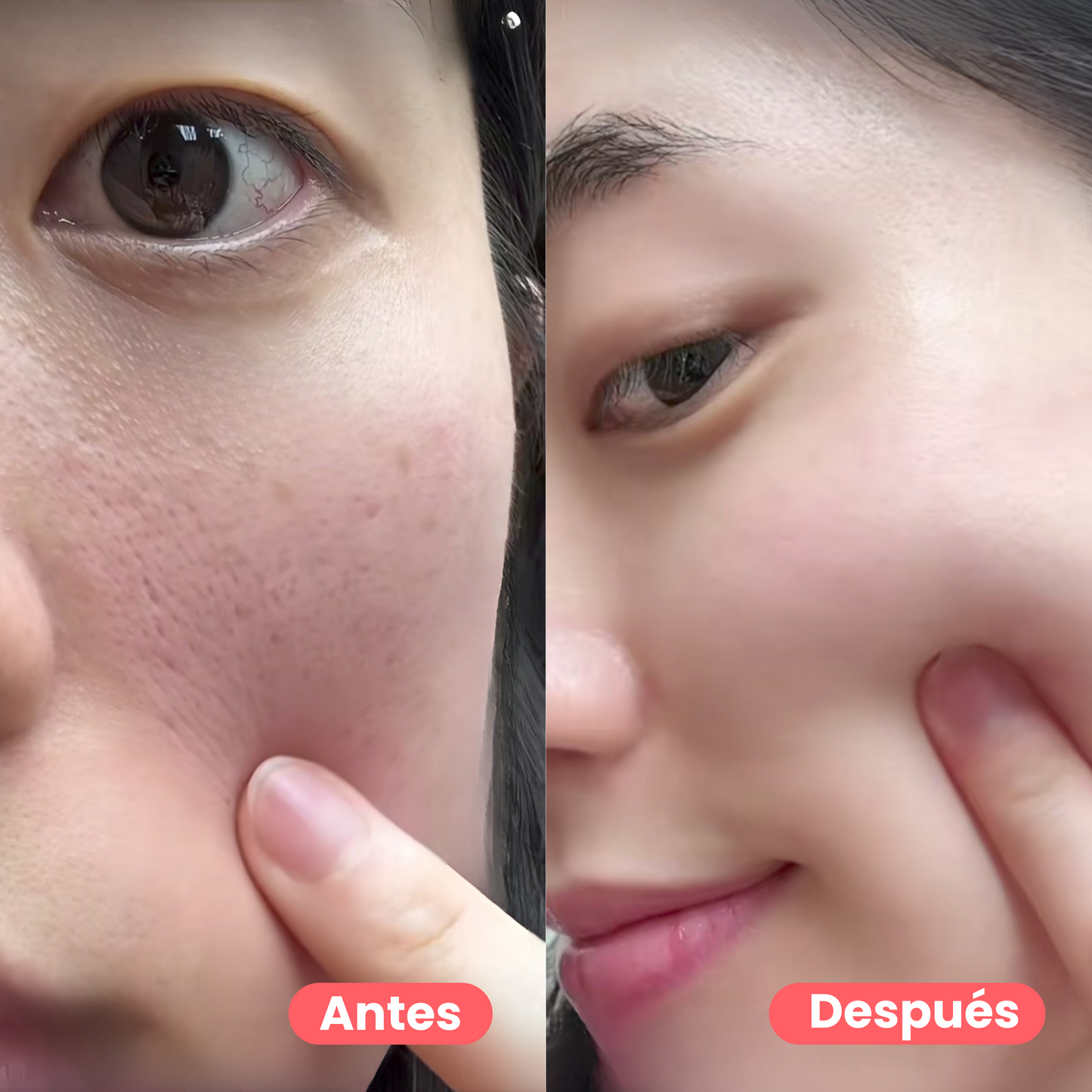 Pack doble limpieza anti poros y puntos negros | Centella Asiática