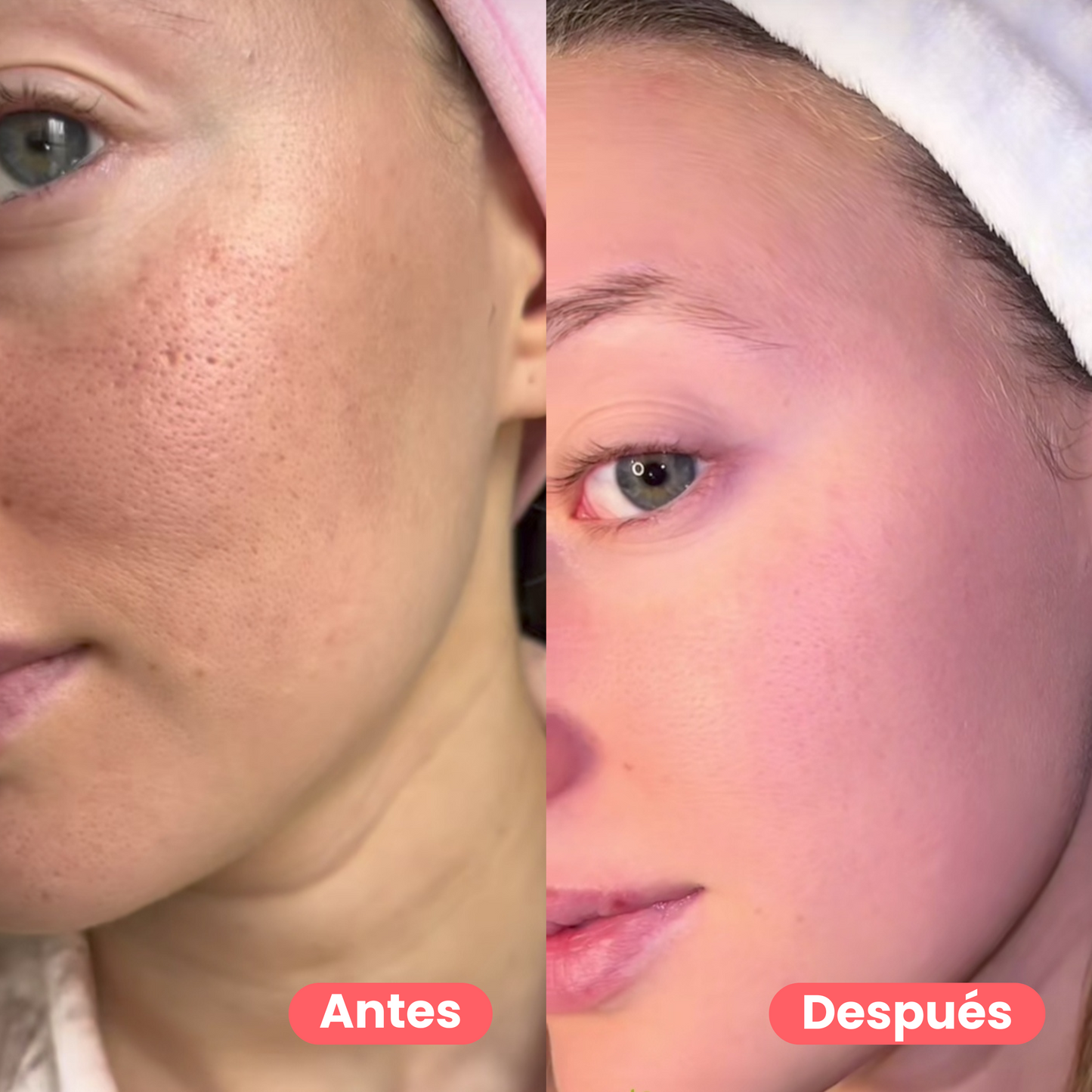 Pack doble limpieza anti poros y puntos negros | Centella Asiática