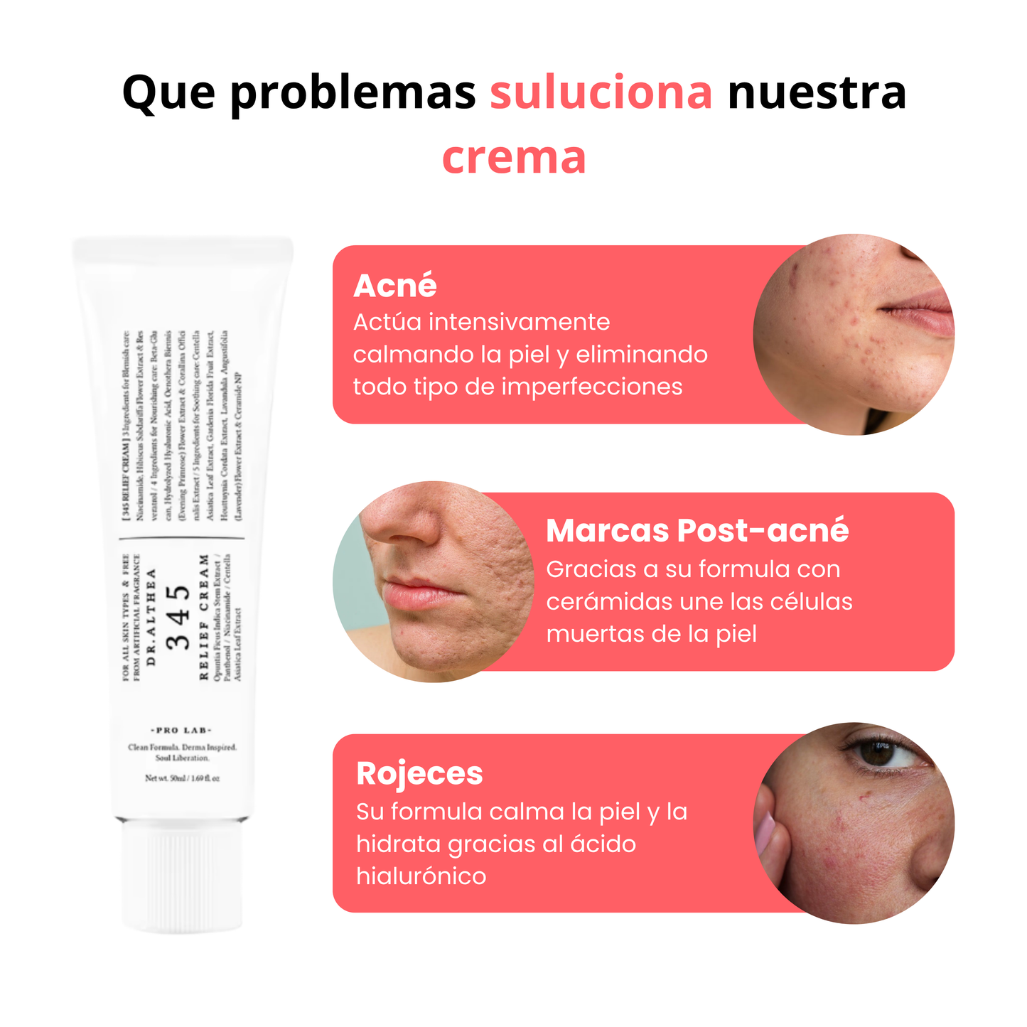 Crema anti acné y rojeces 345 | 50ml