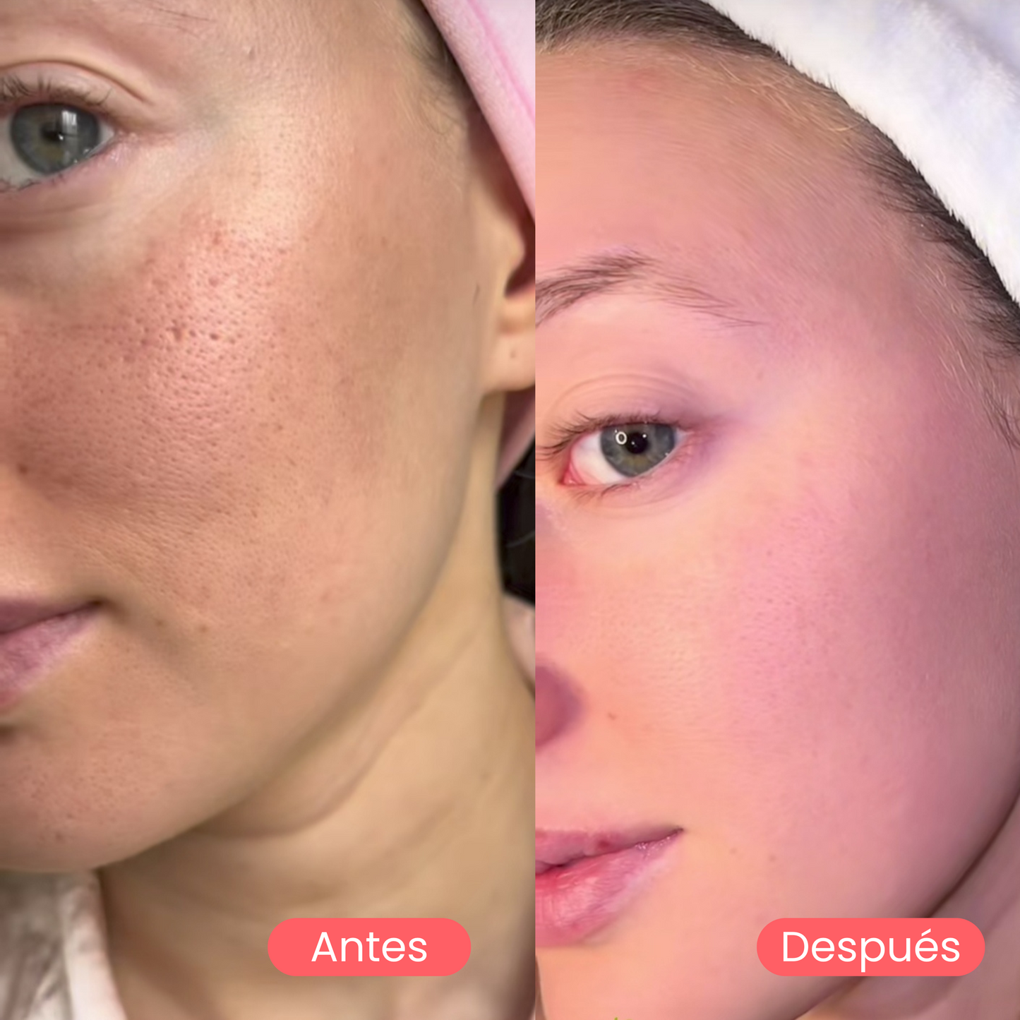Mascarilla anti poros y puntos negros de centella asiática | 27g