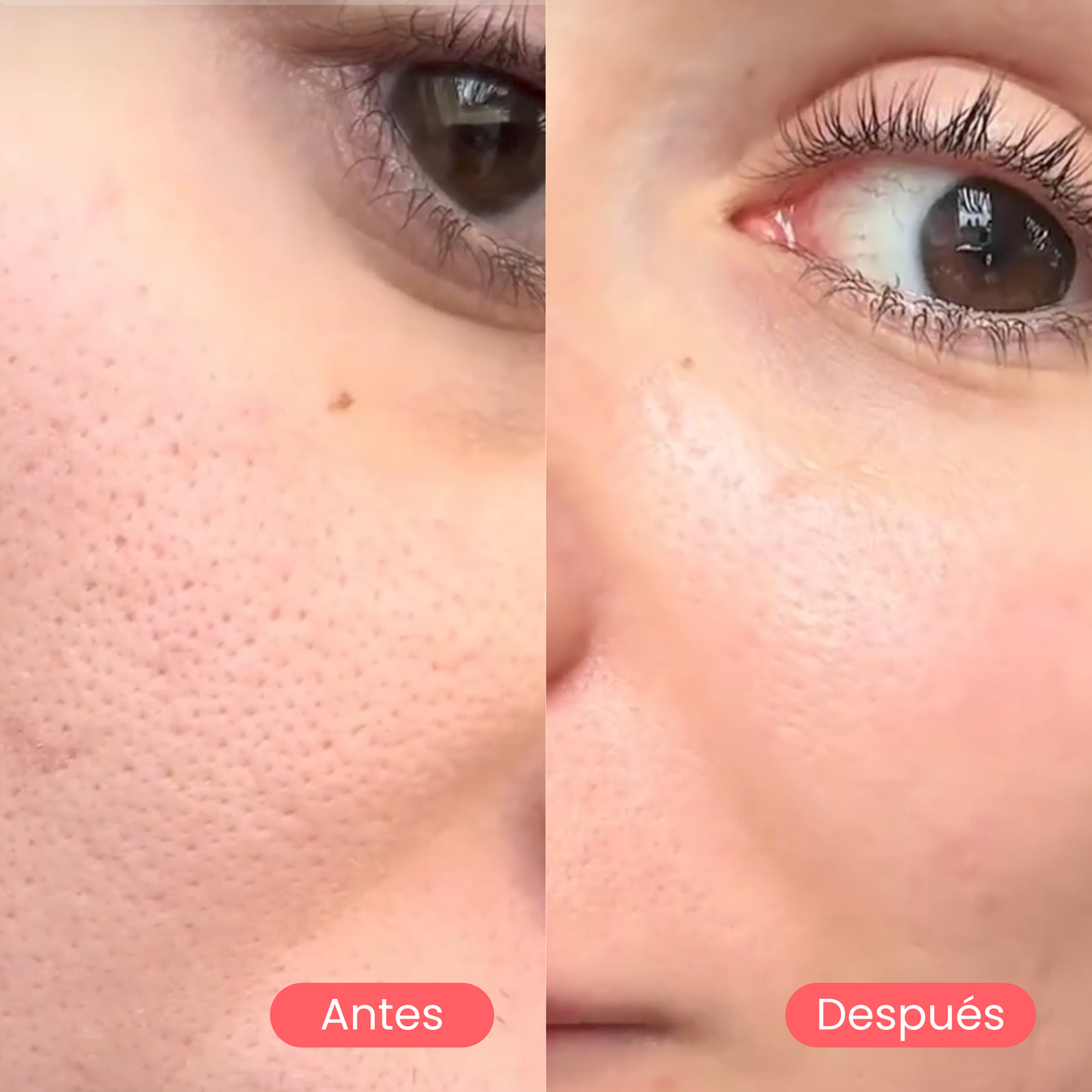 Mascarilla anti poros y puntos negros de centella asiática | 27g
